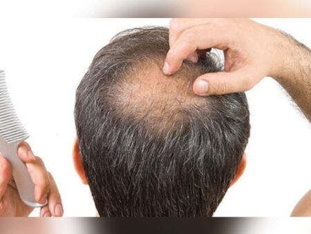 Are you suffering from hair removal? Here's how to stop it