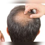 Are you suffering from hair removal? Here’s how to stop
