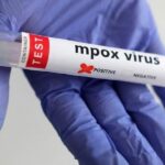 The MPOX epidemic is still a global emergency